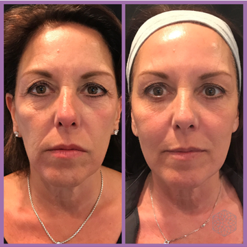 Beauty Microcurrent Facial Toning Massager Harmony Haven